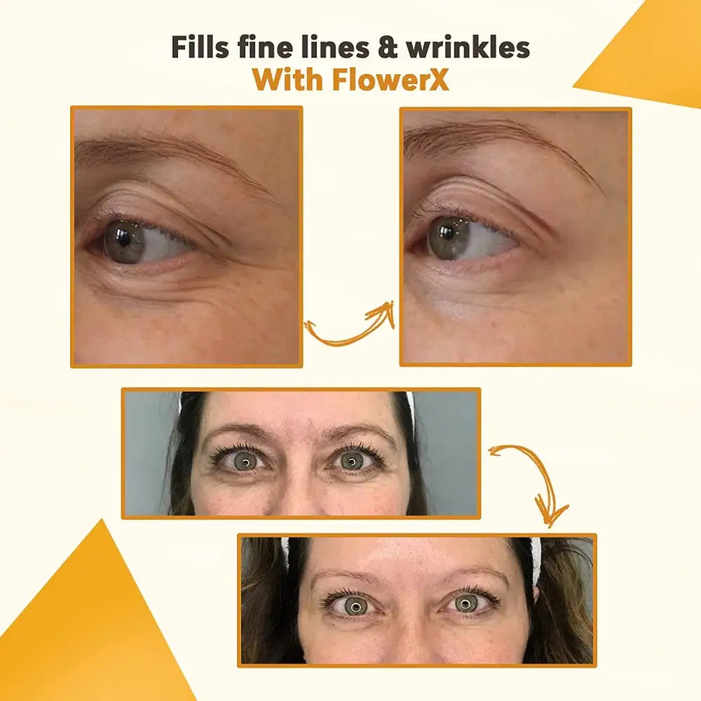 FlowerX Anti Aging Serum, Brightness, Moisturise Under Eye, Dry Oily Combination and Sensitive Skins, Smoother Firmer and Youthful, Fills Up Wrinkles, Sagging & Fine Lines